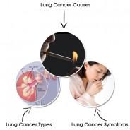 Lung Cancer – Types, Causes & Symptoms