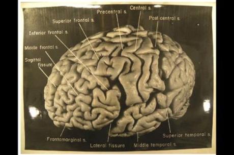 EINSTEIN’S BRAIN SHOW UNIQUE FEATURES