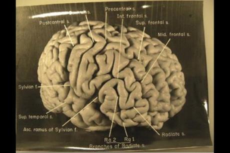 EINSTEIN’S BRAIN SHOW UNIQUE FEATURES