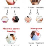 Common Women Health Issues, Symptoms & Treatments