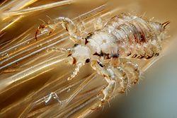 250px Male human head louse Beating Head Lice 