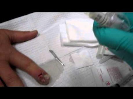 Bar Rot on Steroids YouTube Preview Image