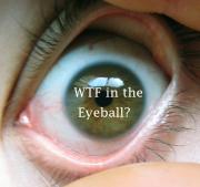 wtf_int_the_eyeball