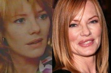 Marg Helgenberger Cosmetic Surgery