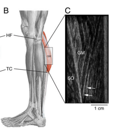 The location of the gastrocnemius (b) and the longer fibers identified in the Twa (c)