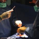 hernia surgery on a child