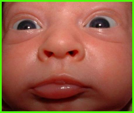 Craziest Babies. Funny Pictures of Ugly Babies.