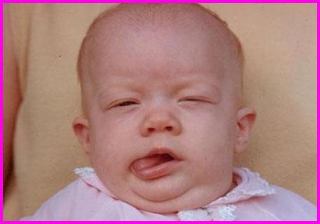 Craziest Babies. Funny Pictures of Ugly Babies.