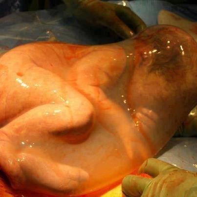 486167 10151424808416663 928050351 n Veiled Birth Image   Giving Birth With The Amniotic Sac Intact