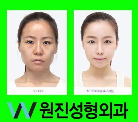 It’s hard to believe that the photographs on this Korean Pop plastic surgery Tumblr are for real, but if so, they’re a scary harbinger for the future of humanity.