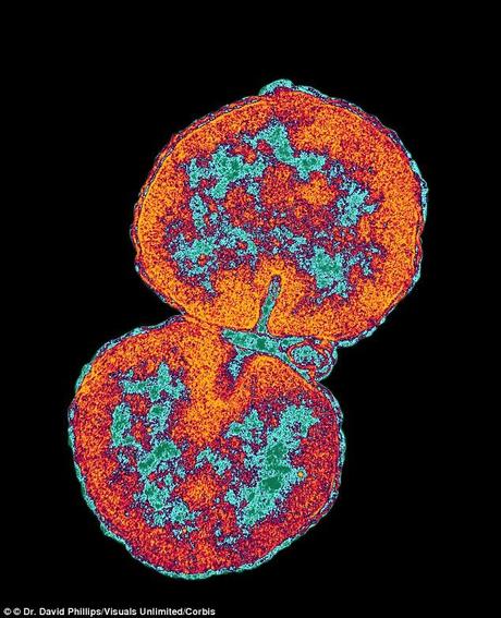 Neisseria gonorrhoeae is the bacteria that causes the sexually transmitted disease gonorrhea - scientists in North America noted in a study released on January 8th that they have detected the first incurable strain of the disease