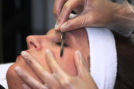 Woman having advanced exfoliation