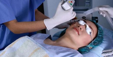 laser treatments