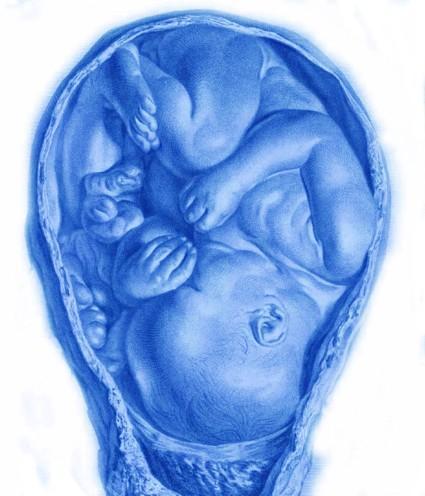 embryo_a_William_Hunter