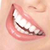 northwest teeth whitening