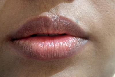 Natural (Pigmented) Lips