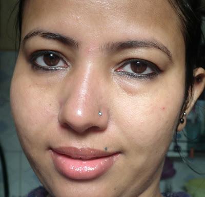Natural, Patch Skin with Pores  around nose