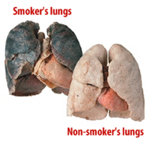 lungs