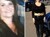 Gastric Bypass: Patient Update Amazing Weight Loss Photos