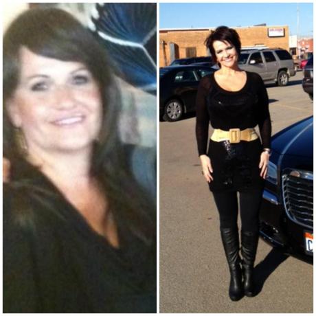 Gastric Bypass Surgery helped Jan lose 126 pounds in 8 months! Doesn't she look wonderful? | BeLiteWeight