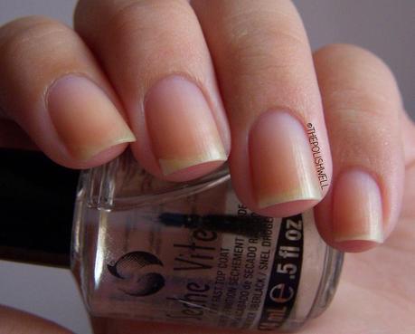 nail-whitening-before