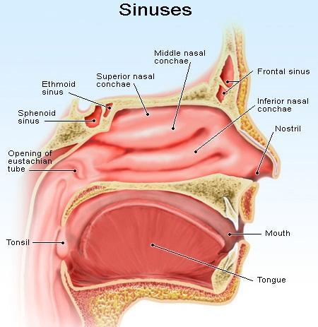 Sinus Infections