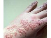 Temporary Tattoos Risk