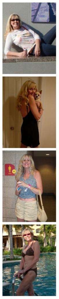 Band to Sleeve Revision Weight Loss Surgery - From a horror story to a happy ending; Gabrielle's experience.