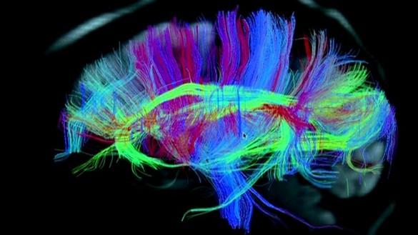 Brain Mapping Can Scientists Finally Read Our Dreams?
