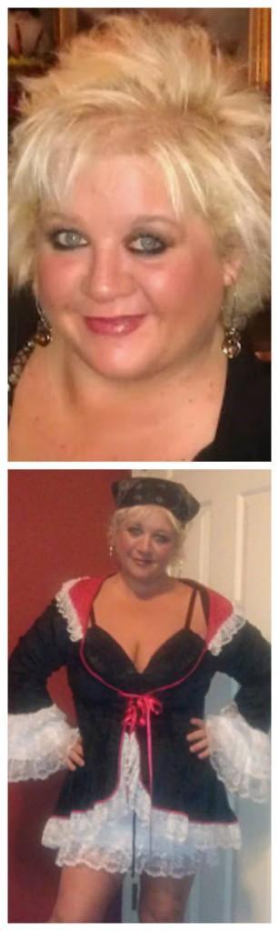 Gastric Sleeve Surgery before and after photos