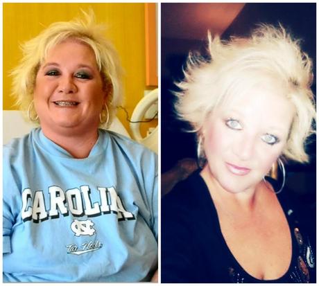 The diet roller coaster has stopped for Stephanie for good! Gastric Sleeve surgery made it possible.