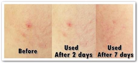 Review on VMV Hypoallergenics Hydra Balance Smart Cleansing Scrub