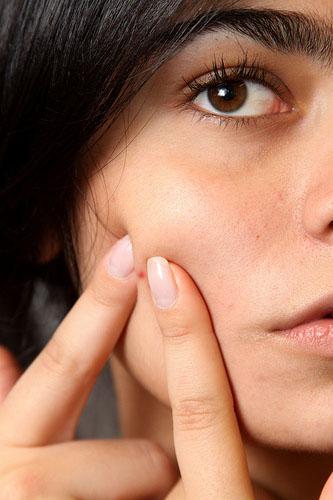 pimple Guest Post: Is Your Makeup Causing Acne?