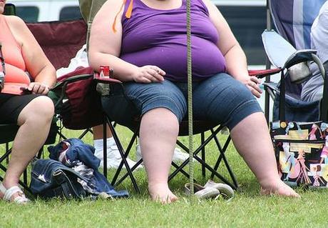 Obesity epidemic: Experts call for a “fat tax”