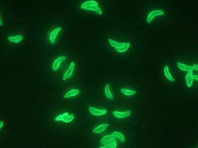 Toxoplasma Gondii