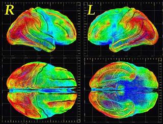 On Dead Salmon, Drugs, and “Lighting Up” the Brain