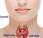 What Need Learn About Thyroid Cancer