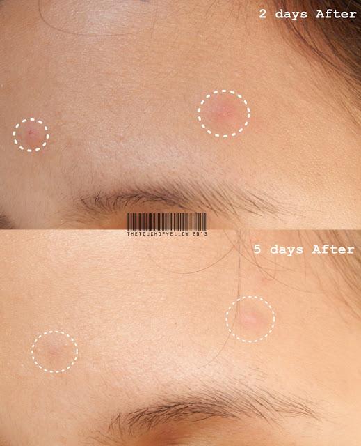 REVIEW:Rojukiss Enca AC Drying Pinky Powder