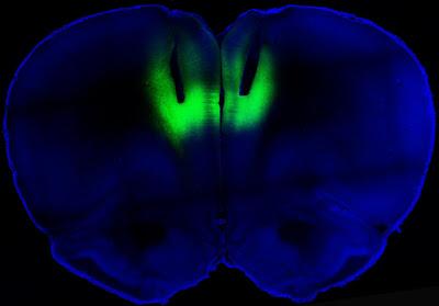 Let the Light Shine In: Addiction and Optogenetics