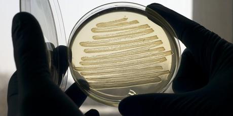 E. coli bacteria have been made to produce diesel fuel (Credit: Marian Littlejohn)