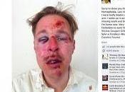 Footnote Violence France: Condemns "Either Side," Frigide Barjot Claims Anti-Gay Caused State