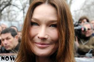 Carla Bruni botox plastic surgery