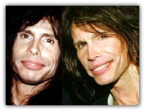 Steven Tyler plastic surgery photos