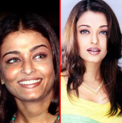 Aishwarya Rai plastic surgery photos