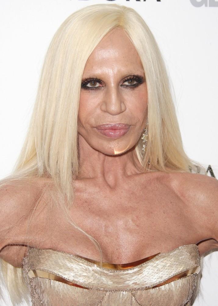 donatella versace plastic surgery