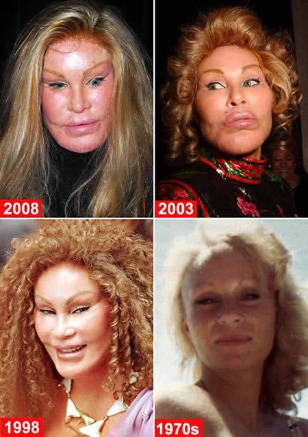 Jocelyn plastic surgery