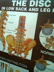 Tips On How To Handle Your Back Discomfort