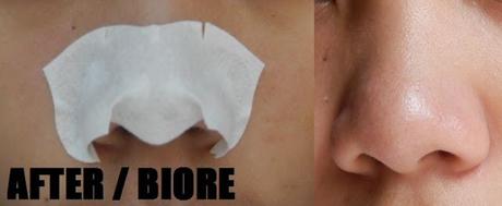 NOSE PACK SHOWDOWN | Biore & SkinMiso Review