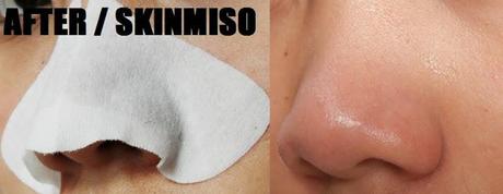 NOSE PACK SHOWDOWN | Biore & SkinMiso Review