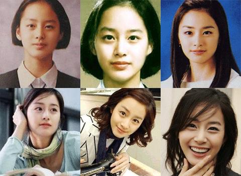 kpop plastic surgery